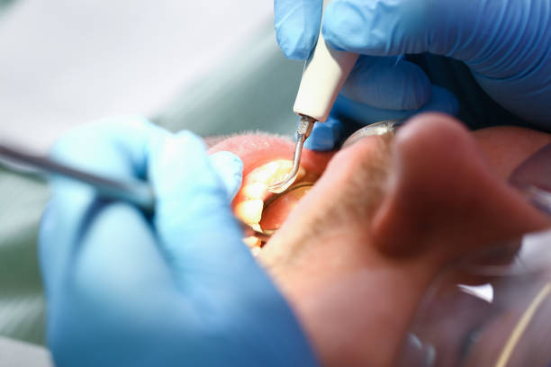 Best Emergency Dental Extractions in Madison Park, NJ